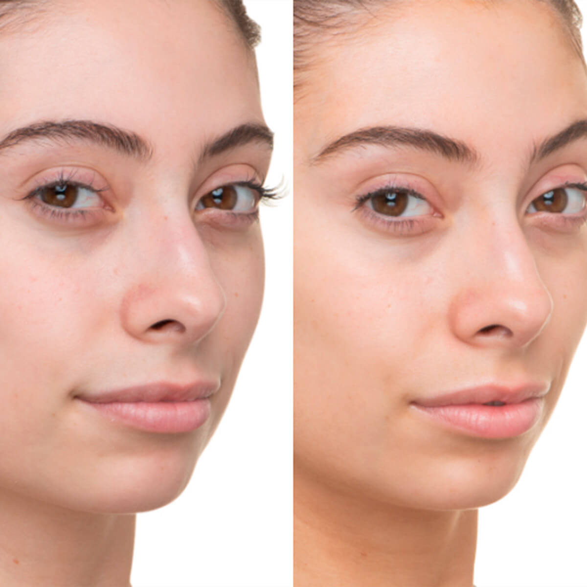 BYE BYE SERUM (SUEROS LUMINOSOS E HIDRATANTES PARA ROSTRO)